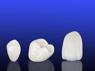 HowToTakeCareOfNewDentalCrowns