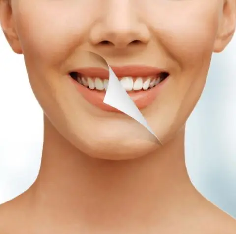 Teeth Whitening Winnipeg