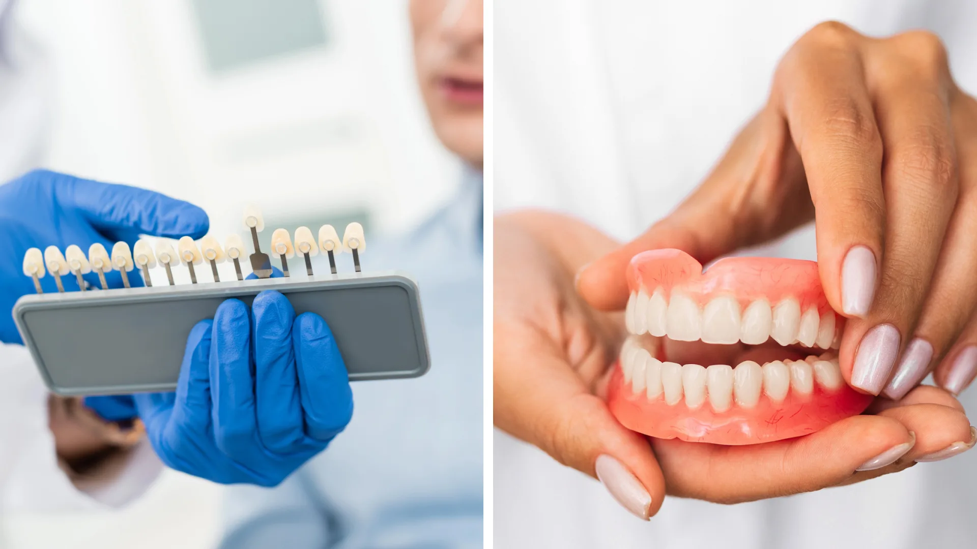 Dental-Implants Vs. Dental-Dentures