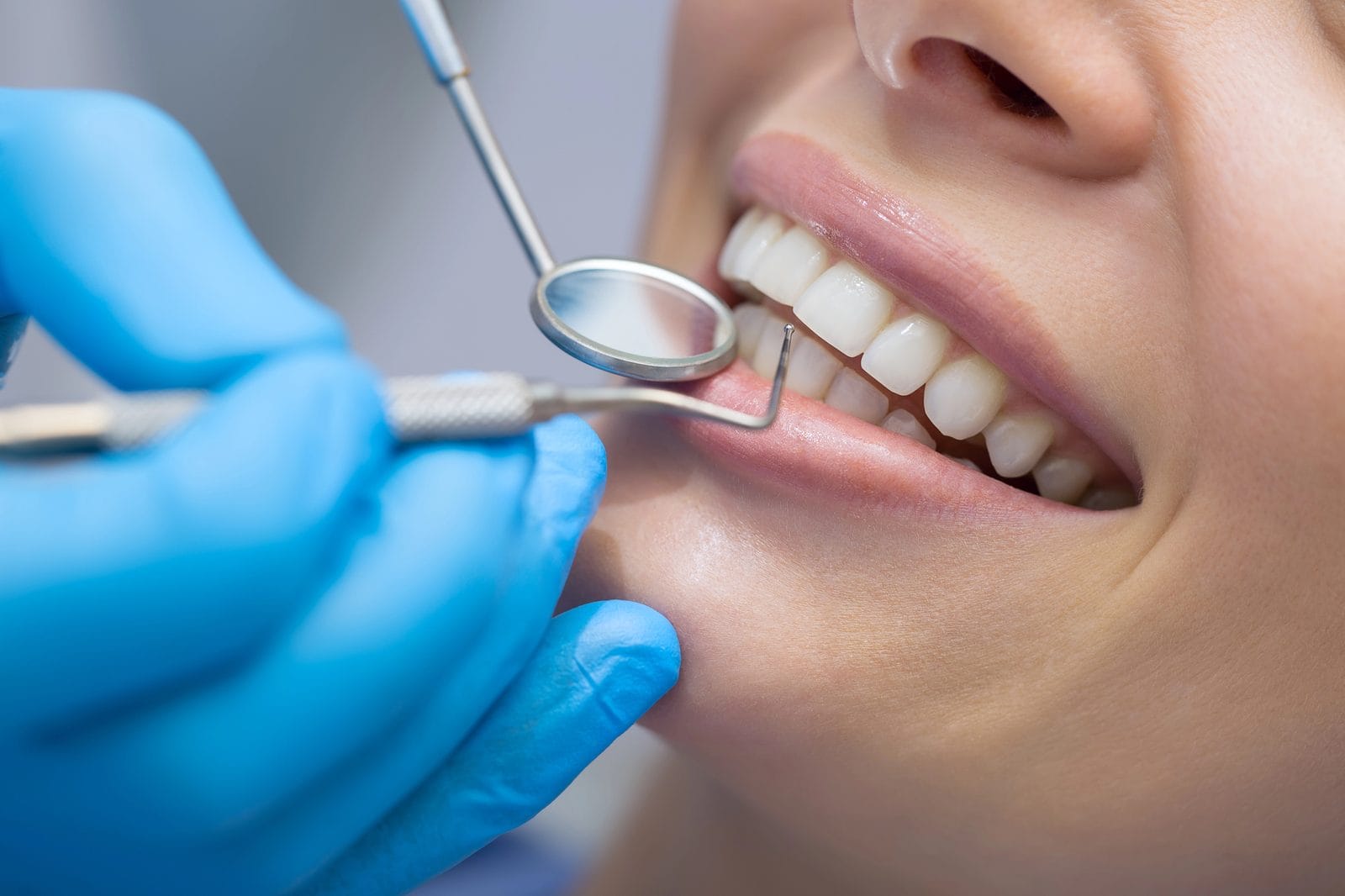 Dentist Examining Teeth With A Dental Mirror During A New Patient Exam In Winnipeg